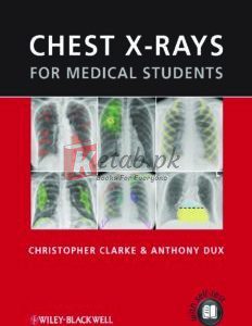 Chest X-rays for Medical Students By Christopher Clarke & Anthony Dux(paperback) Medical Book